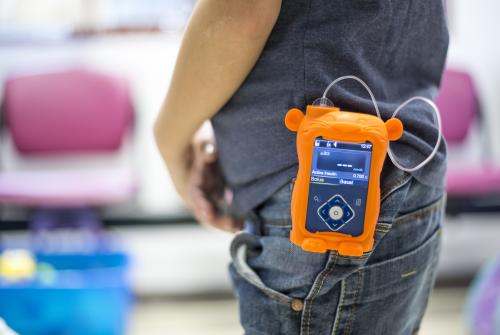 The new Medtronic insulin pump offered at GOSH